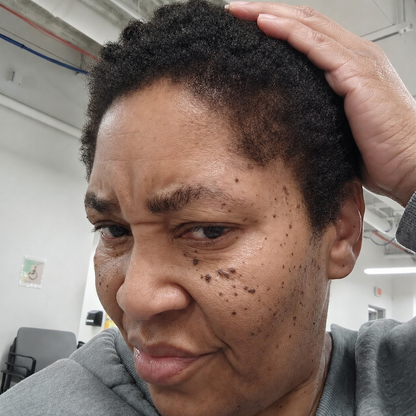 Minoxidil Hair growth Solution™