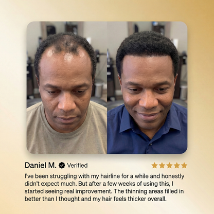 Advanced Batana Hair Regrowth Therapy